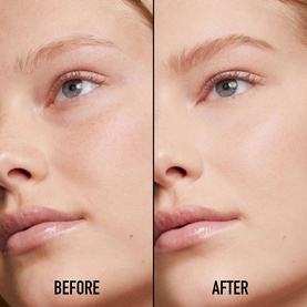 Forever Skin Correct