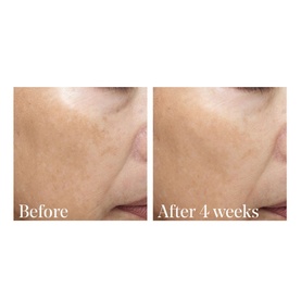 Essential-C Firming Radiance Day Cream