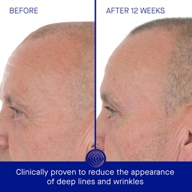 The Retinol Serum