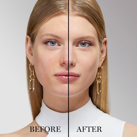 Lanc&ocirc;me Teint Idole Ultra Wear Foundation before and after split image showing improved skin coverage and even complexion on model's face