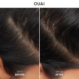 Antidandruff Shampoo