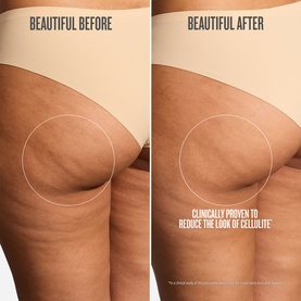 Sol De Janeiro Bum Bum Cream Refill Pods before and after showing clinically proven reduction in the look of cellulite on thigh area