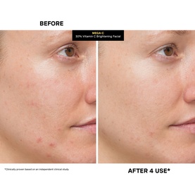 Mega-C&trade; 30% Vitamin C Brightening Facial