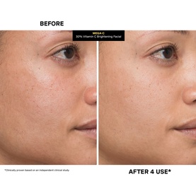 Mega-C&trade; 30% Vitamin C Brightening Facial