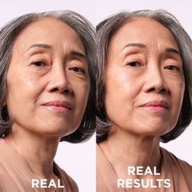 Bye Bye Under Eye Bags Rapid Bag Reducer