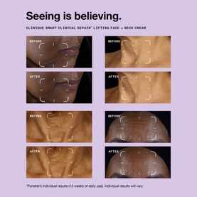 Smart Clinical Repair&trade; Lifting Face + Neck Cream