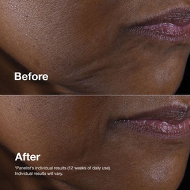 Smart Clinical Repair&trade; Lifting Face + Neck Cream
