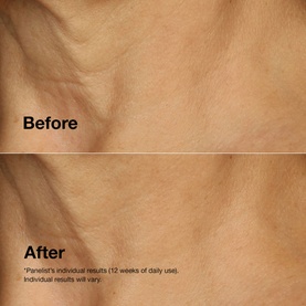 Smart Clinical Repair&trade; Lifting Face + Neck Cream