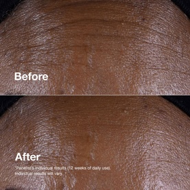Smart Clinical Repair&trade; Lifting Face + Neck Cream