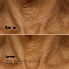 Smart Clinical Repair&trade; Lifting Face + Neck Cream