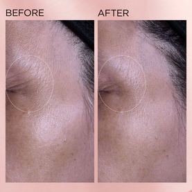 Retinol + HPR Rapid Skin Renewing Water Cream