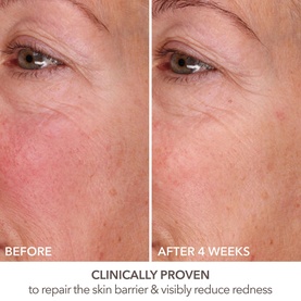 DermInfusions&trade; Fill + Repair Serum