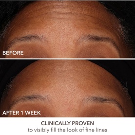 DermInfusions&trade; Fill + Repair Serum