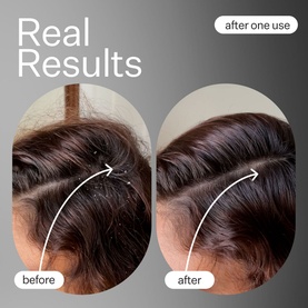Scalp Renew