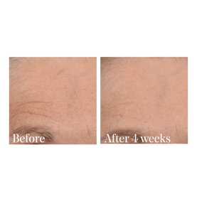 Retinal ReSculpt Overnight Treatment
