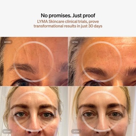 Skincare Serum & Cream Starter Kit