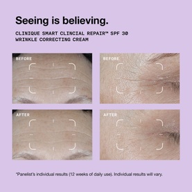 Smart Clinical Repair&trade; SPF 30 Wrinkle Correcting Cream