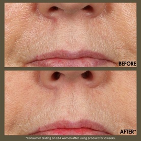 Plantscription&trade; Active Wrinkle Correction Serum