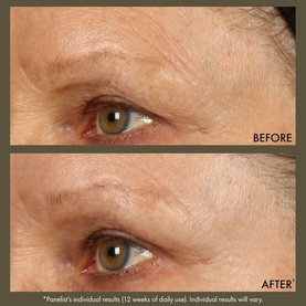 Plantscription&trade; Active Wrinkle Correction Serum