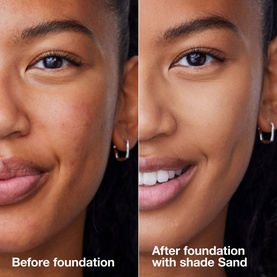 Before and after split showing Clinique Anti-Blemish Solutions Liquid Makeup foundation in shade Sand applied to model's skin