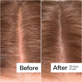 Microbiome Cooling Scalp Serum