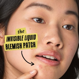 Truly Targeted Blemish-Clearing Solution