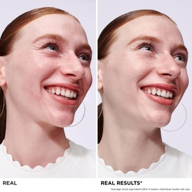 Bye Bye Redness Serum