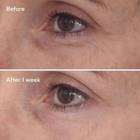 Retinal Eye Serum