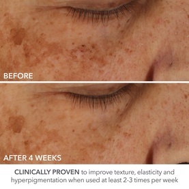 Perfectly Dosed Retinol Treatment Pads 0.2%