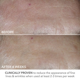 Perfectly Dosed Retinol Treatment Pads 0.2%