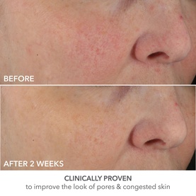 Perfectly Dosed Retinol Treatment Pads 0.2%