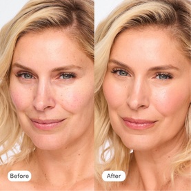 Before and after split showing TRINNY LONDON BFF De-Stress Tinted Serum in Claire, demonstrating improved skin tone and reduced redness