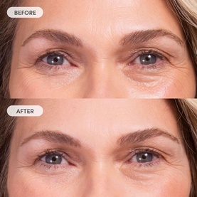 Miracle Blur Line Filler