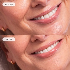 Miracle Blur Line Filler