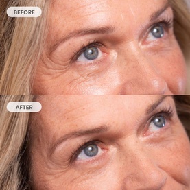 Miracle Blur Line Filler