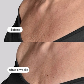 The Elevator Neck + D&eacute;collet&eacute; Concentrate