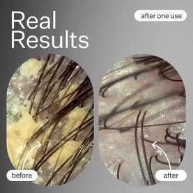 Cold Processed Hair Cleanse Jumbo