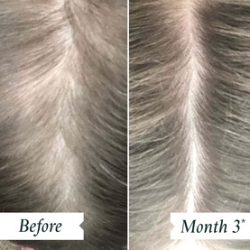 Density Preserving Scalp Drops