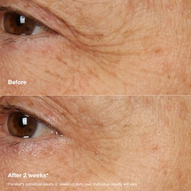 Smart Clinical Repair&trade; Overnight Recovery Cream + Mask