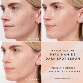 Watch Ya Tone Niacinamide Dark Spot Serum Refill