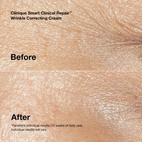 Get Smart Anti-Ageing Skincare Gift Set