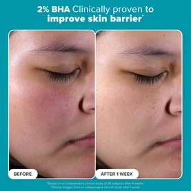 The Exfoliation Icons Kit