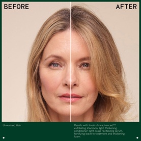 Invati Ultra Advanced&trade; Exfoliating Shampoo Light