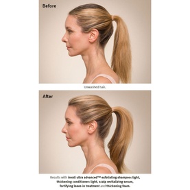 Invati Ultra Advanced&trade; Fortifying Leave-In Treatment