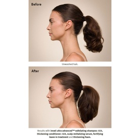 Invati Ultra Advanced&trade; Fortifying Leave-In Treatment