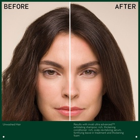 Invati Ultra Advanced&trade; Exfoliating Shampoo Rich