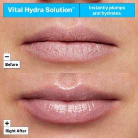Vital Hydra Solution&trade; Hydrating Lip Mask