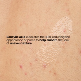Salicylic Acid 0.5% Body Serum
