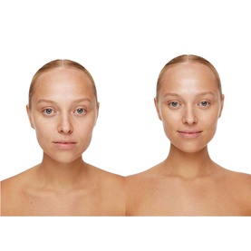 Universal Glow Treatment SPF30