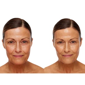 Universal Glow Treatment SPF30